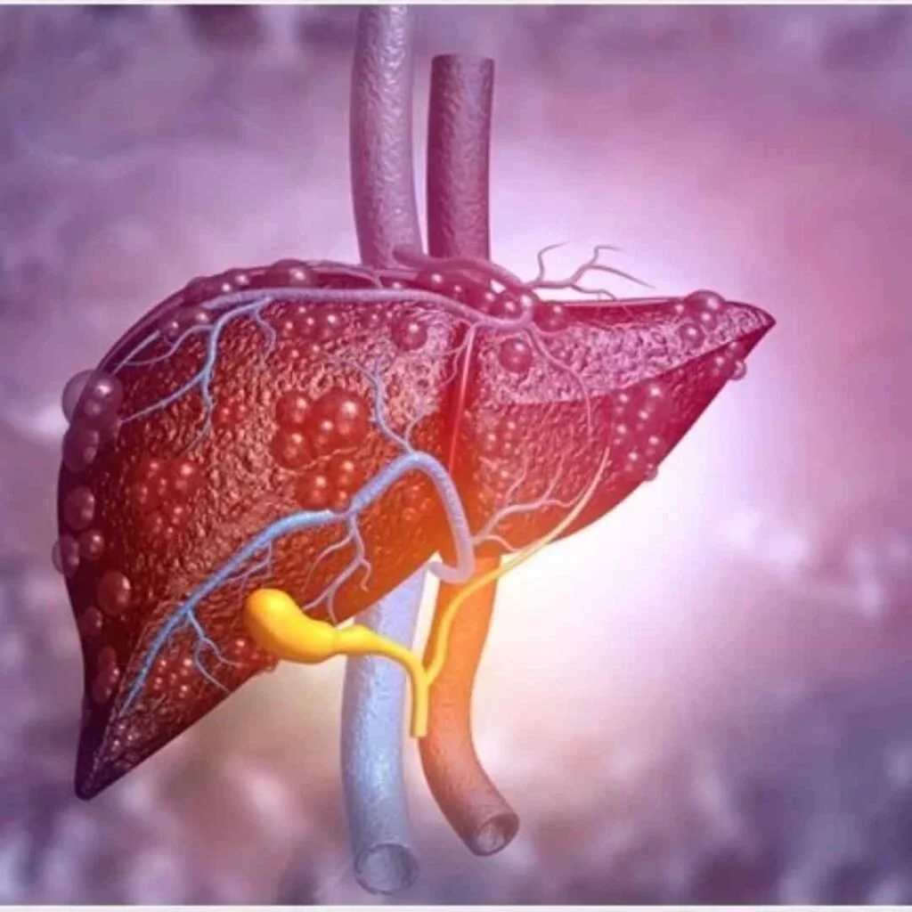 Fatty Liver & Liver Care